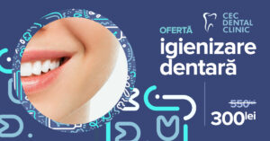 Read more about the article Igienizarea dentară profesională la CEC Dental Unirii: Un zâmbet sănătos și strălucitor